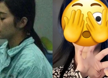 30 tỷ, 8 năm phẫu thuật, làm đám cưới với bác sĩ thẩm mỹ, số phận hot girl xinh đẹp nay ra sao?