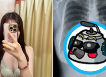 Khoe ảnh chụp X-quang vòng một, cô nàng streamer hút hơn 1,25 triệu lượt xem, CĐM dậy sóng chỉ trích