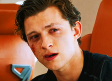 Sao nam đình đám bị chấn động não, “bom tấn” 5.300 tỷ đồng phải tạm dừng