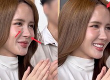 Gương mặt nhiều di chứng thẩm mỹ của Thiều Bảo Trâm đang khiến nhiều người lo lắng