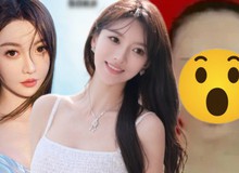 Hoa khôi sinh con cho Huỳnh Hiểu Minh “dao kéo” 100% cơ thể, xem diện mạo trước chỉnh sửa mà sốc nặng