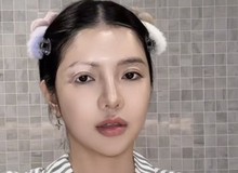 Mỹ nhân Việt mắc bệnh hiếm chỉ 2% dân số thế giới gặp phải