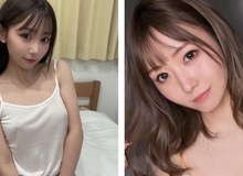 Tự ti suốt 25 năm vì căn bệnh "khó nói", hot girl xinh đẹp chia sẻ quá khứ xấu hổ với crush, fan cảm thông tột độ