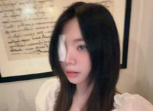 Biến đau thương thành "cợt nhả", Remind khiến fan "té ngửa" với màn xuất hiện chấn động