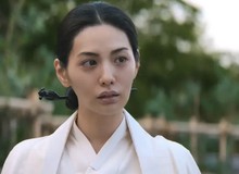 Mỹ nhân đẹp nhất thế giới vướng tranh cãi vì tiêm filler lố