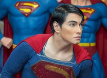 Gặp gỡ người trải qua 23 lần phẫu thuật để trở thành "Superman"