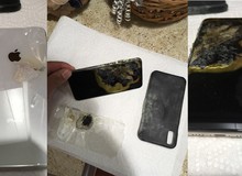 Mua chưa được 1 tháng, iPhone Xs Max bất ngờ phát nổ trong túi quần