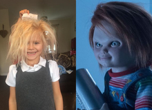 Cô bé 7 tuổi mắc hội chứng "tóc rối" hệt như búp bê sát nhân trong phim kinh dị