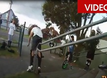 Những tai nạn vô cùng đau đớn nhưng không kém... hài hước