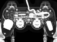 5 căn bệnh kỳ quái nhất do games gây ra