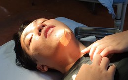 NTN đăng ảnh ngã dập cằm sau "tai nạn nghề nghiệp", cộng đồng mạng than thở: Tội anh quá