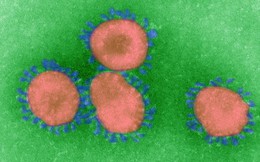 Đi tìm lời giải cho độc tính của virus corona: Khi nào chúng gây chết người, khi nào chỉ gây cúm?