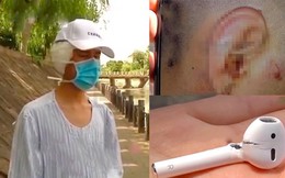 AirPods phát nổ ngay trên tai, một người đàn ông gặp thương tật nặng nhưng bất ngờ lại bị cả cộng đồng lên án