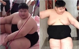 14 tuổi nặng 180kg, cậu nhóc ăn gấp 7 lần người bình thường, phụ huynh phải lên YouTube cầu viện "cứu trợ"