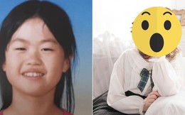 Chi tiền tỷ làm phẫu thuật từ năm 18 tuổi để được “giống người thường”, diện mạo của idol người Nhật bây giờ ra sao?