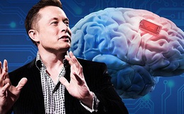 Elon Musk tự tin về công nghệ 'cấy chip não'
