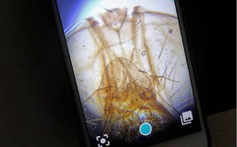 Camera smartphone có thể soi ra vi khuẩn, "nghe vô lý nhưng lại rất thuyết phục"!