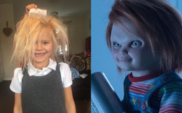 Cô bé 7 tuổi mắc hội chứng "tóc rối" hệt như búp bê sát nhân trong phim kinh dị