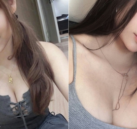 Bị đồn đoán thẩm mỹ, "dao kéo" vòng một, hot girl xinh đẹp bức xúc, tung bằng chứng thanh minh