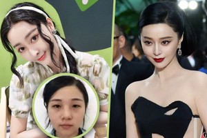 37 ca phẫu thuật, gần 30 tỷ đồng và cái kết cay đắng của người phụ nữ muốn trở thành Phạm Băng Băng thứ hai