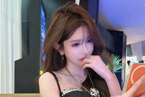 Livestream với đầu gối thâm tím, nữ streamer khiến người xem đặt nghi vấn