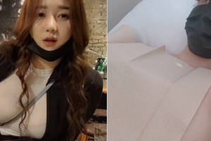 Bị nghi ngờ dao kéo, nữ streamer thẳng thừng tới bệnh viện, livestream công khai chứng minh