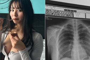 Hot girl Nhật công khai ảnh chụp X-quang, hút 43 triệu lượt xem