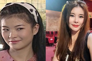 Nữ NSƯT từng đóng vợ anh Núi: U50 chi 1 tỉ đồng sang Hàn đại phẫu nhan sắc, chọn sống độc thân