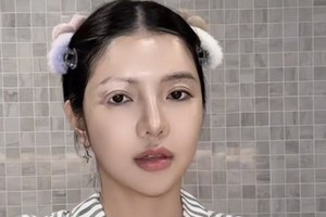 Mỹ nhân Việt mắc bệnh hiếm chỉ 2% dân số thế giới gặp phải