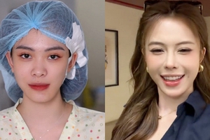 Hà Môi “đắp tiền lên mặt” để sửa những gì? Còn chiếc mũi “đang hếch dần và méo” giờ ra sao?