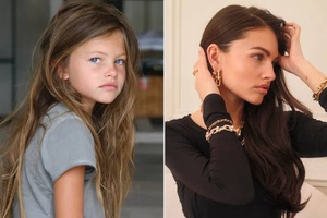 Nhan sắc cực phẩm của "cô bé đẹp nhất thế giới" ở tuổi 25, sở hữu khối tài sản hơn 100 tỷ đồng