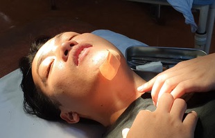 NTN đăng ảnh ngã dập cằm sau "tai nạn nghề nghiệp", cộng đồng mạng than thở: Tội anh quá