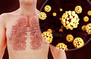 [Infographic] Đây là cách virus Covid-19 tàn phá cơ thể người