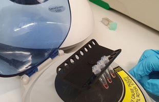 Anh đang phát triển một loại xét nghiệm Covid-19 nhanh và chính xác nhất thế giới, chỉ mất 30 phút và không có kết quả giả