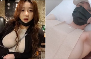 Bị fan nghi ngờ về việc "hack cheat vòng một", nữ streamer xinh đẹp livestream luôn cảnh vào bệnh viện chứng thực ngực tự nhiên