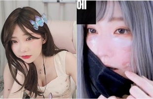 Đang là hot girl vạn người mê, nữ streamer gây sốc khi công khai gương mặt biến dị, lý do khiến ai cũng bất ngờ