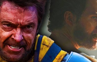 “Người Sói” Hugh Jackman hé lộ cái tên phù hợp nhất cho vai trò Wolverine kế nhiệm