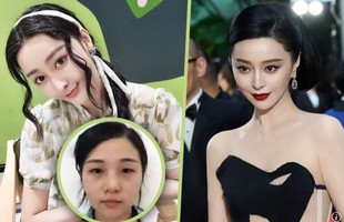 37 ca phẫu thuật, gần 30 tỷ đồng và cái kết cay đắng của người phụ nữ muốn trở thành Phạm Băng Băng thứ hai