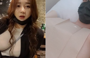 Bị nghi ngờ dao kéo, nữ streamer thẳng thừng tới bệnh viện, livestream công khai chứng minh
