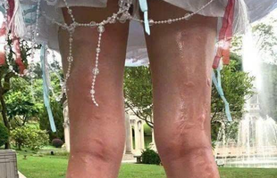 Nữ coser xinh đẹp "gặp hoạ" khi đang tác nghiệp, nhìn ảnh khiến người xem nào cũng phải xót xa