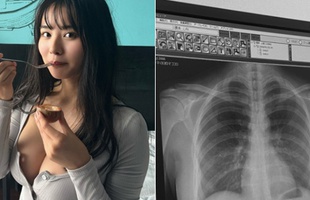 Hot girl Nhật công khai ảnh chụp X-quang, hút 43 triệu lượt xem