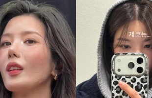 Nữ thần Waterbomb che mũi vì "dao kéo" hỏng?