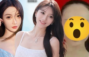 Hoa khôi sinh con cho Huỳnh Hiểu Minh “dao kéo” 100% cơ thể, xem diện mạo trước chỉnh sửa mà sốc nặng