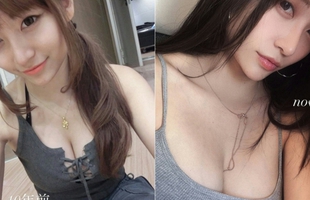 Bị đồn đoán thẩm mỹ, "dao kéo" vòng một, hot girl xinh đẹp bức xúc, tung bằng chứng thanh minh