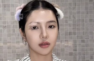 Mỹ nhân Việt mắc bệnh hiếm chỉ 2% dân số thế giới gặp phải