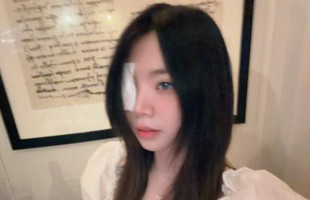 Biến đau thương thành "cợt nhả", Remind khiến fan "té ngửa" với màn xuất hiện chấn động