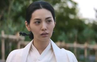Mỹ nhân đẹp nhất thế giới vướng tranh cãi vì tiêm filler lố