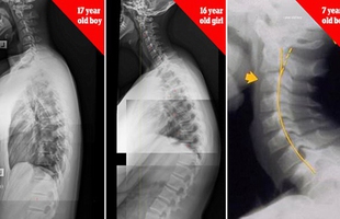 Bức ảnh cho thấy sự đáng sợ từ việc nghiện chơi game điện thoại