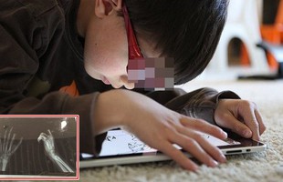 Tự chặt đứt ngón tay vì bị bố mẹ trách mắng khi chơi game