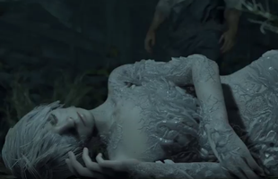 Tin đồn đã thành sự thật: Zoe bị Capcom biến thành con quái vật gớm ghiếc trong DLC Resident Evil 7